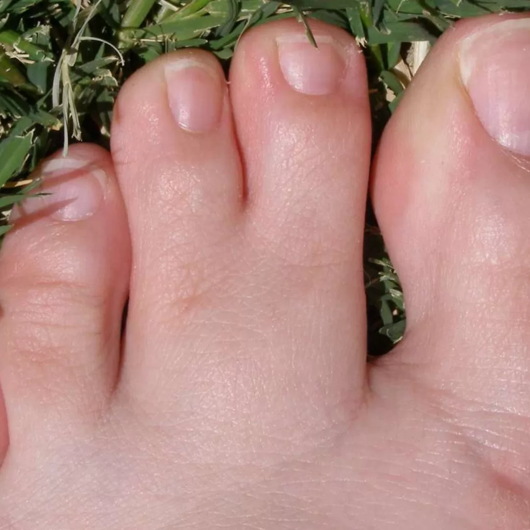 Webbed Toes Spiritual Meaning Uncovered